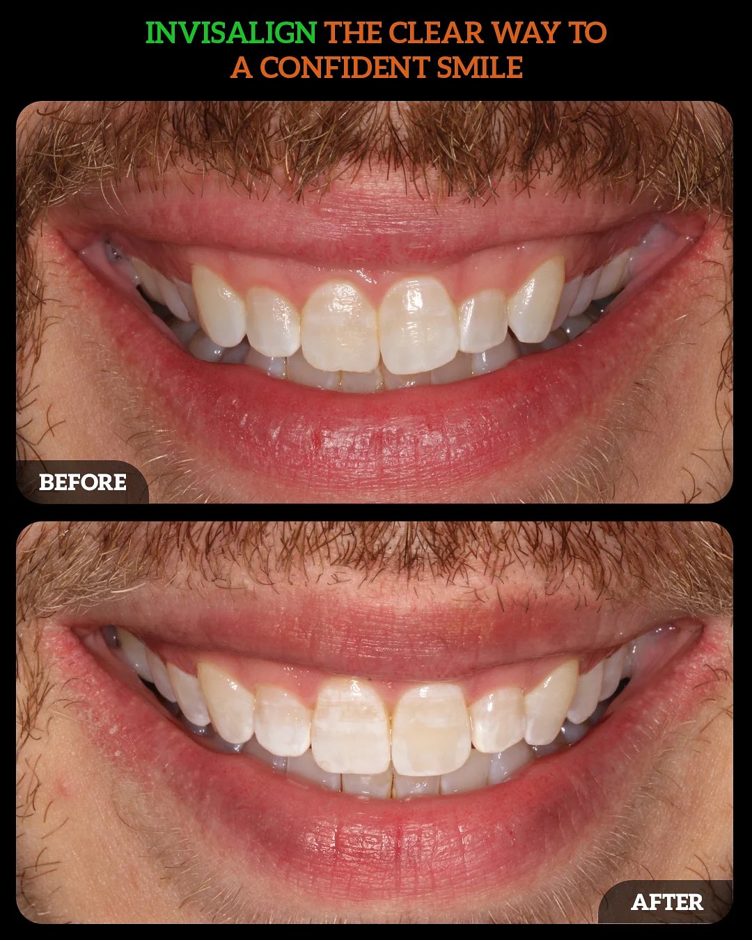 538376105_18528444808010625_4843684668764073295_n