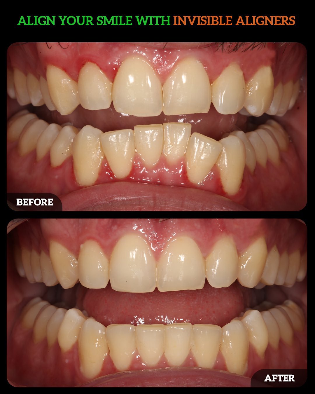 549030083_18532844731010625_3200660071672758639_n