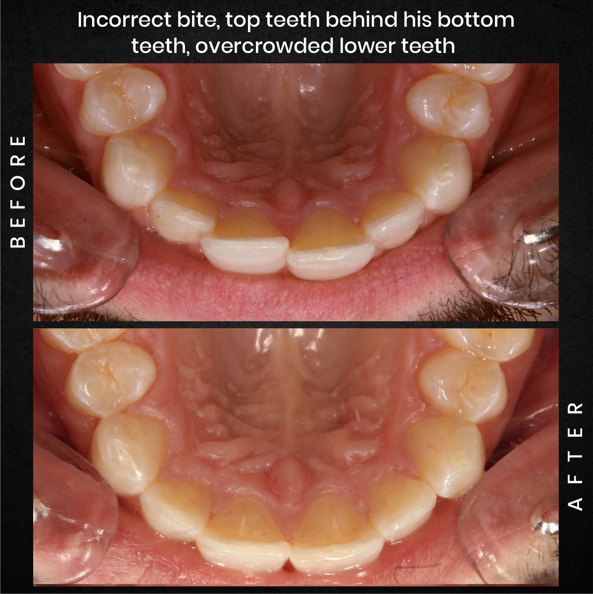 DMD-AUG-POST-16-BA-CAROUSEL-ADAM-BARSTOW_2