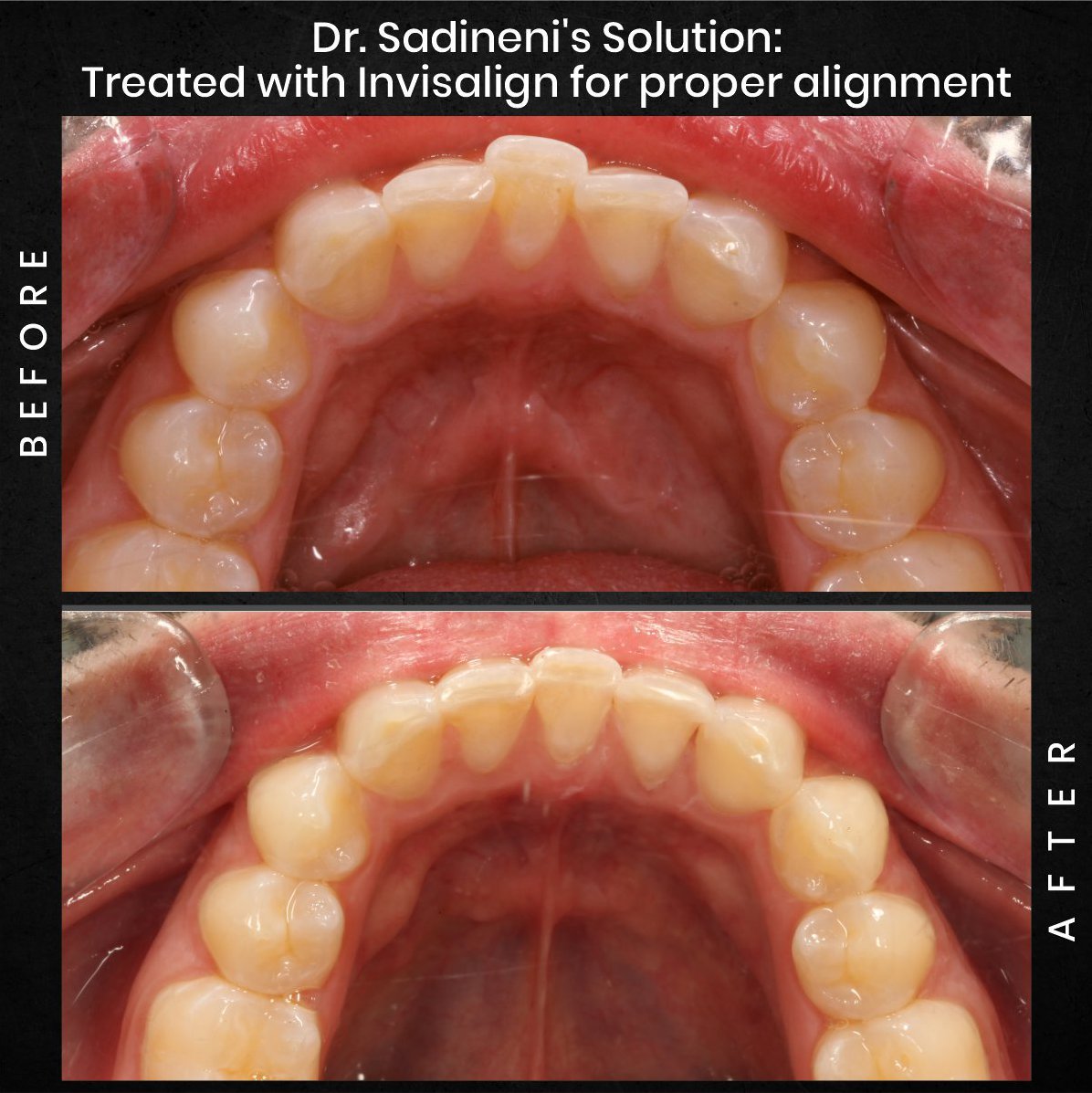 DMD-AUG-POST-16-BA-CAROUSEL-ADAM-BARSTOW_3