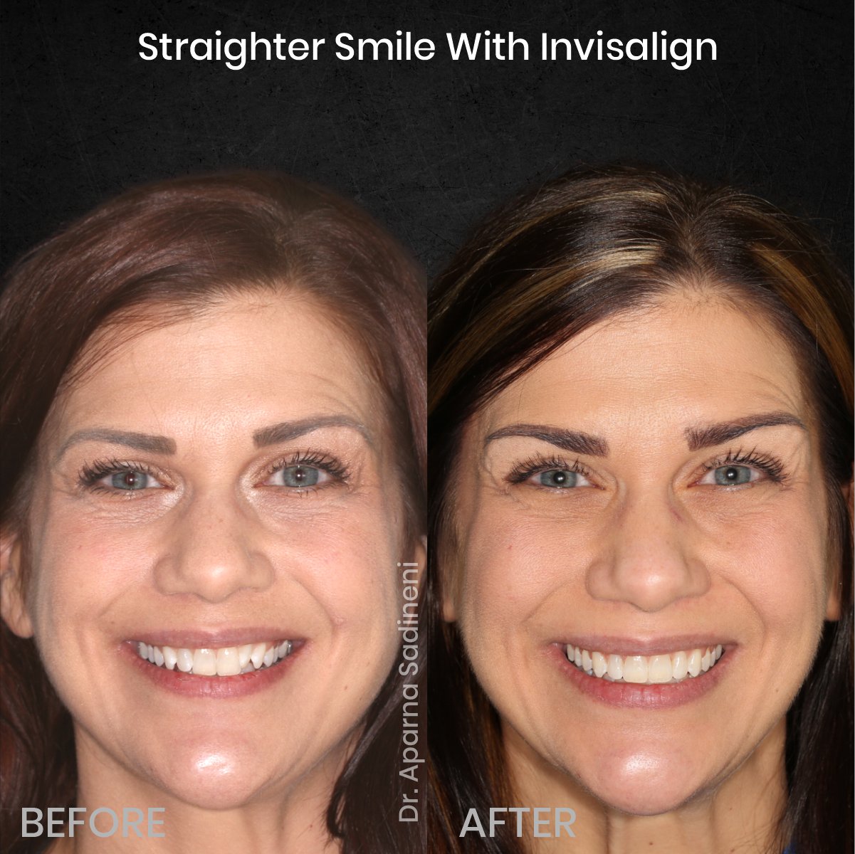 DMD-AUG-POST-18-BA-CAROUSEL-MELISSA-CLOSSER_1