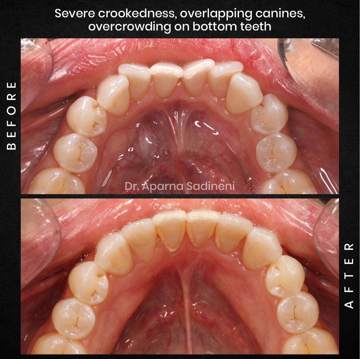 DMD-AUG-POST-18-BA-CAROUSEL-MELISSA-CLOSSER_2