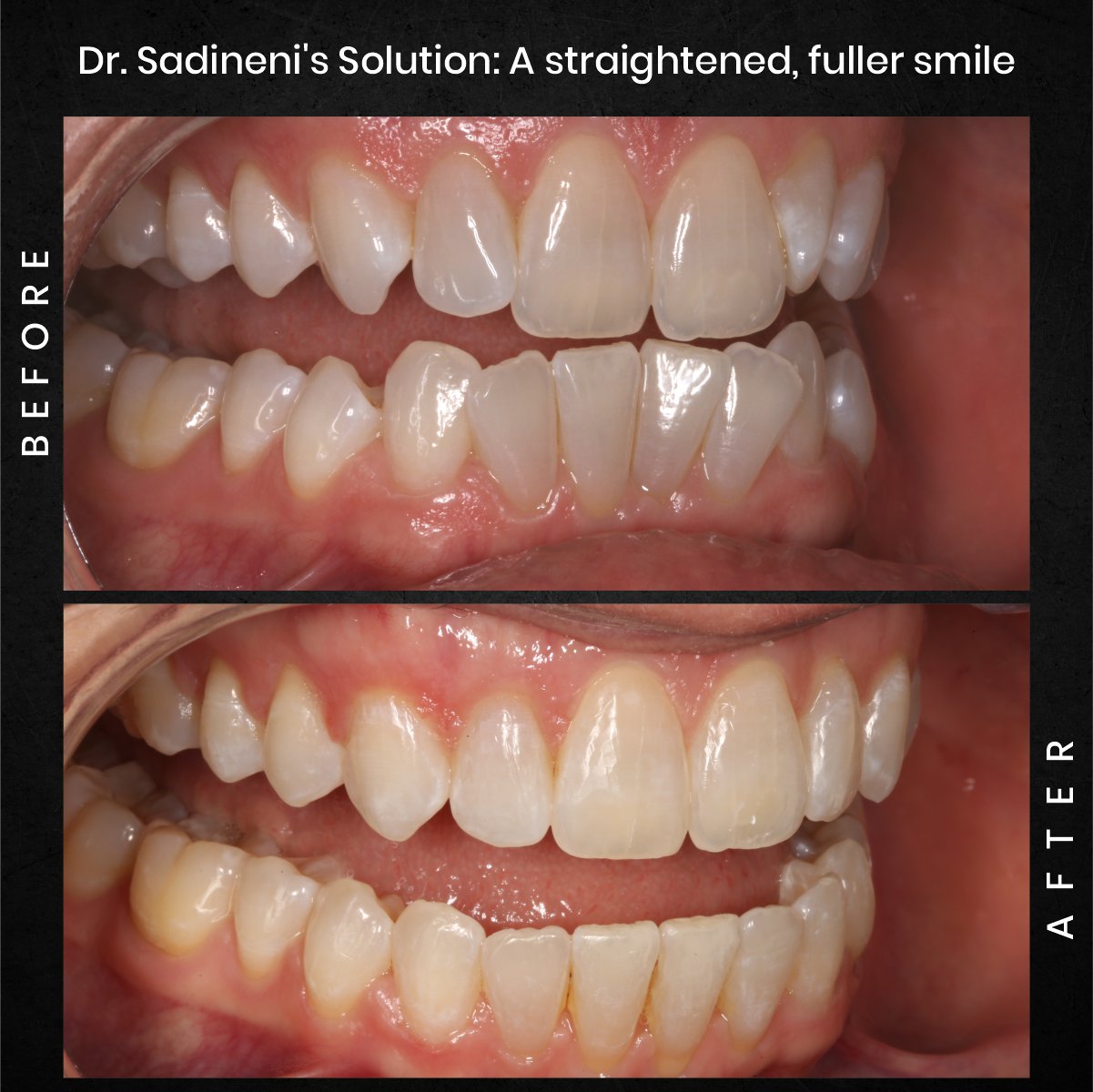 DMD-AUG-POST-18-BA-CAROUSEL-MELISSA-CLOSSER_3