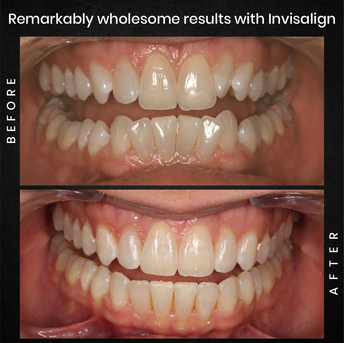 DMD-AUG-POST-18-BA-CAROUSEL-MELISSA-CLOSSER_4