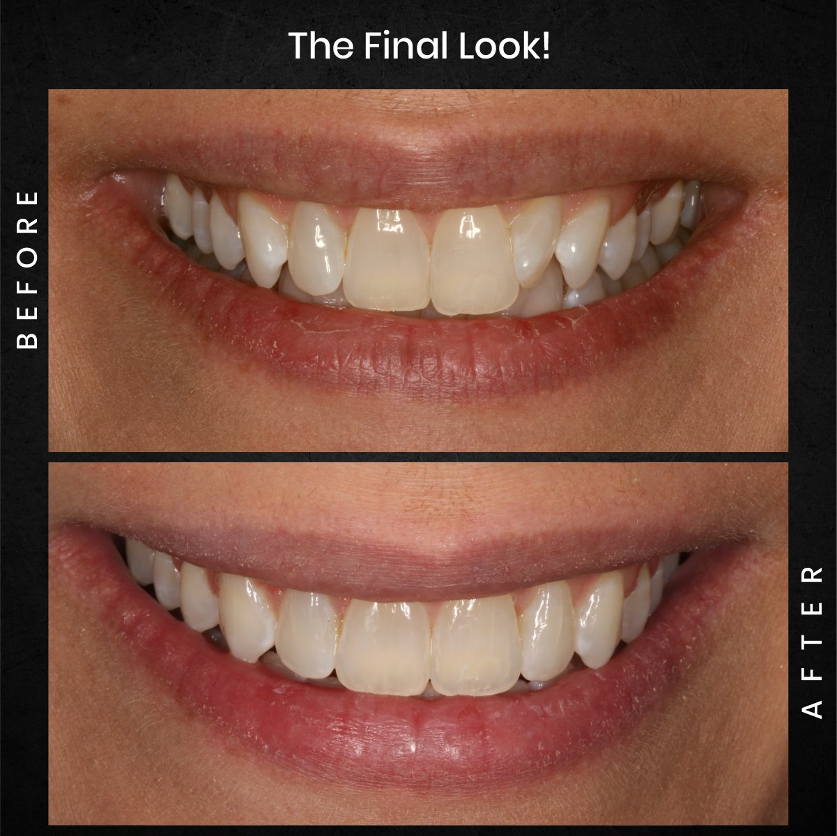 DMD-AUG-POST-18-BA-CAROUSEL-MELISSA-CLOSSER_5