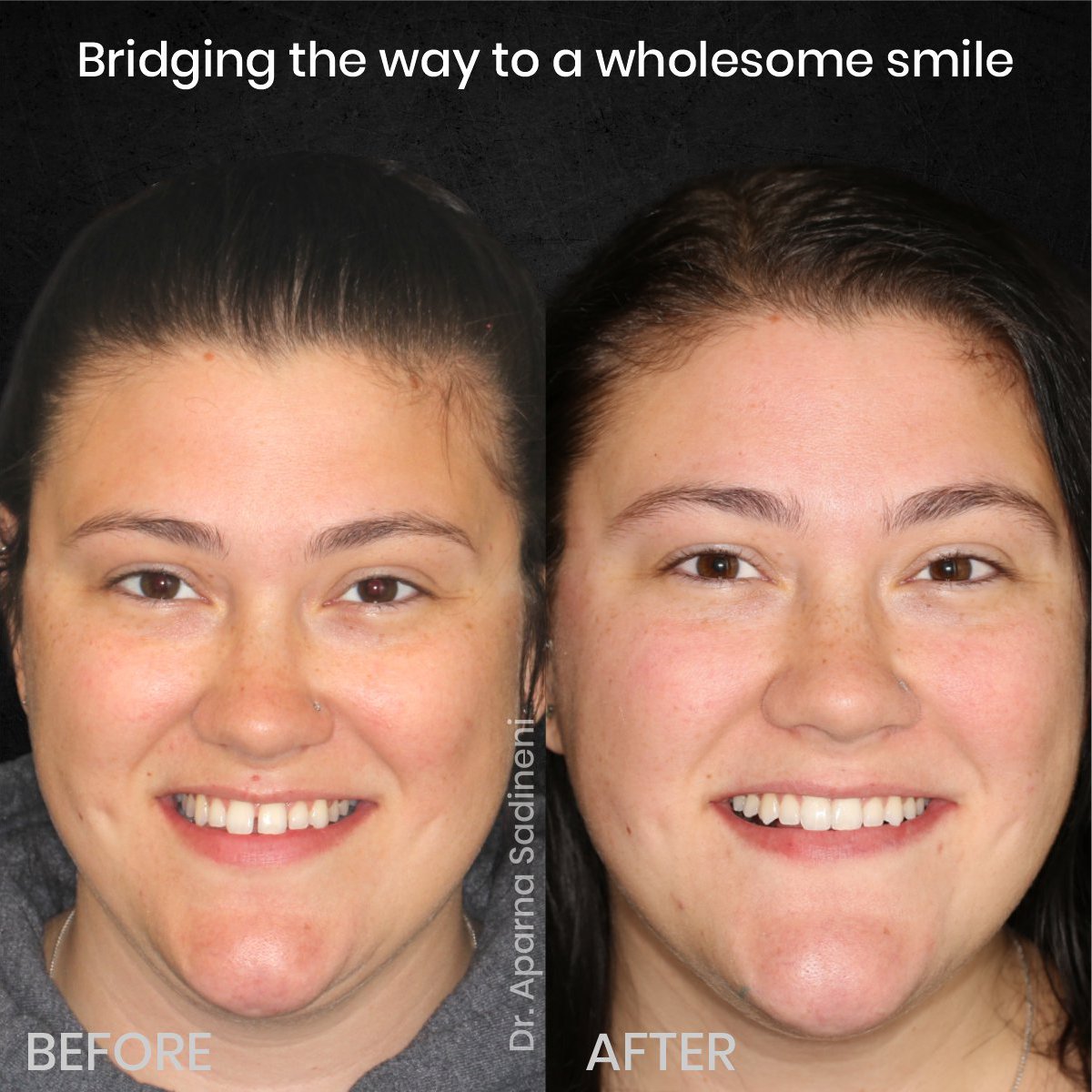 DMD-AUG-POST-28-BA-CAROUSEL-HAYLEY-STAKEM_1