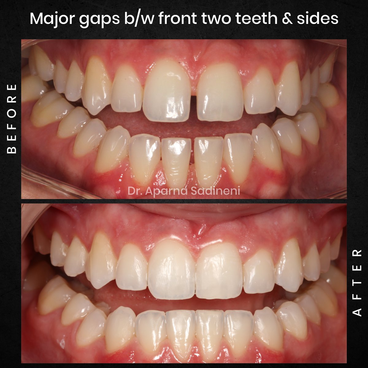 DMD-AUG-POST-28-BA-CAROUSEL-HAYLEY-STAKEM_2