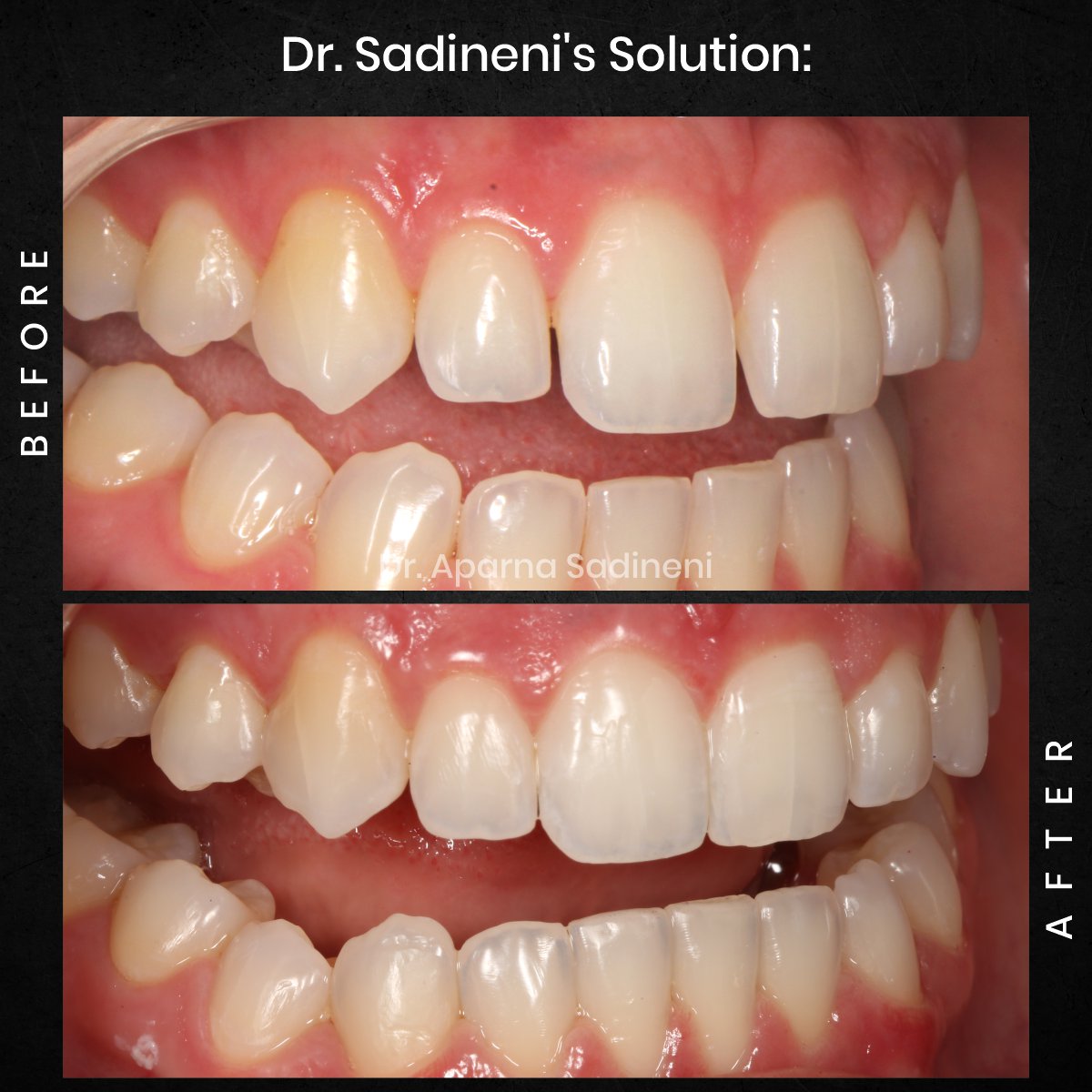 DMD-AUG-POST-28-BA-CAROUSEL-HAYLEY-STAKEM_3