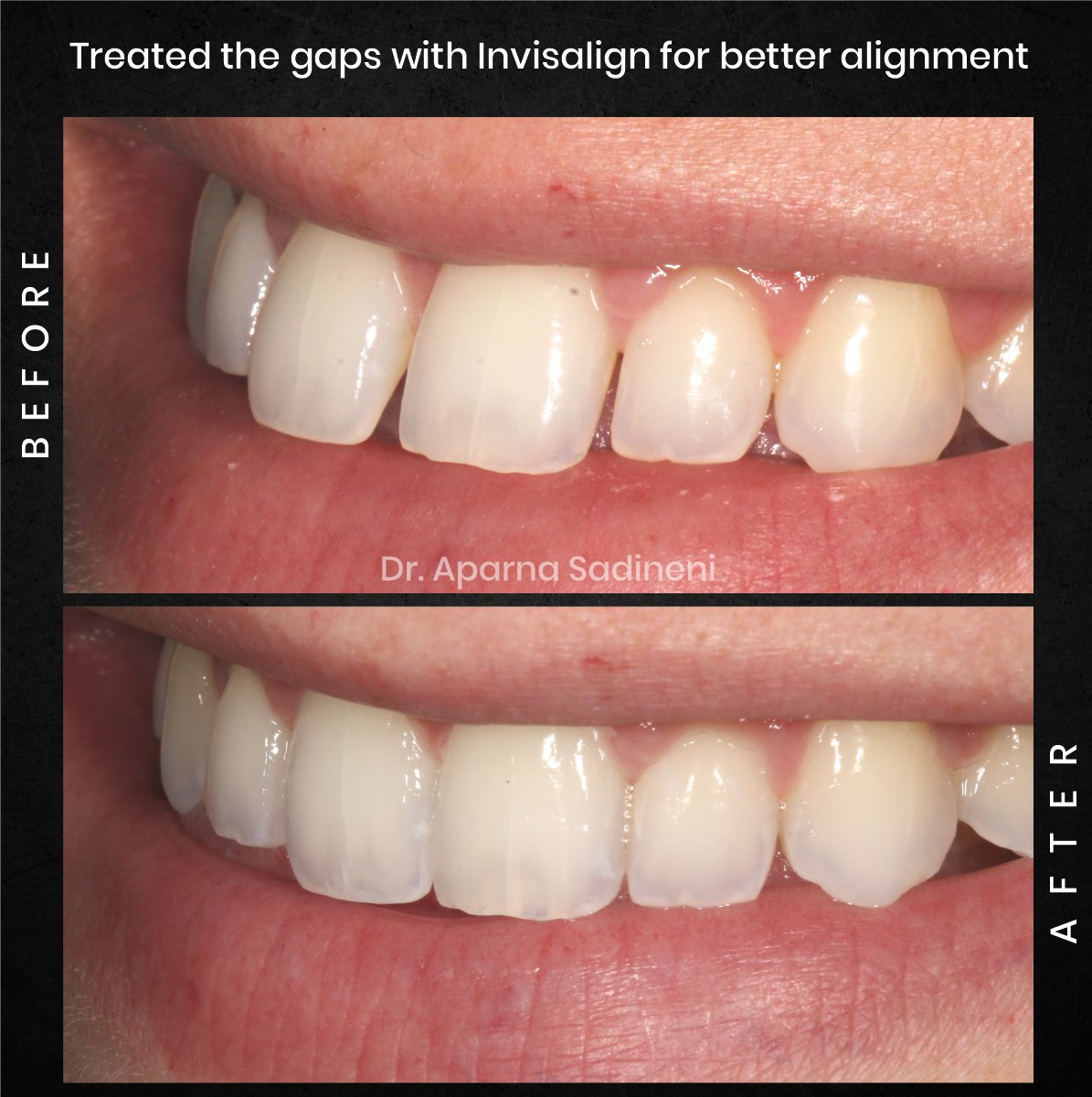 DMD-AUG-POST-28-BA-CAROUSEL-HAYLEY-STAKEM_4