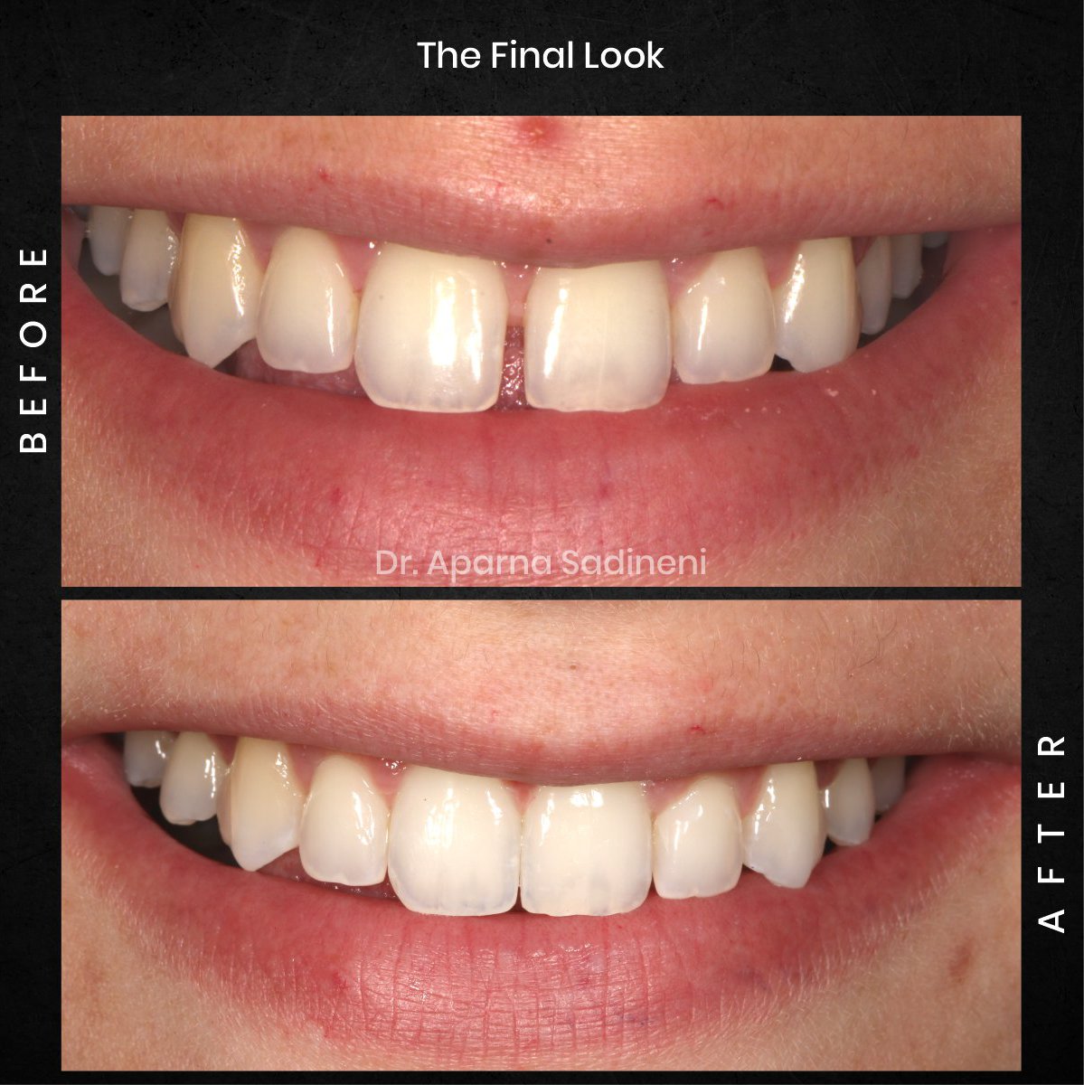 DMD-AUG-POST-28-BA-CAROUSEL-HAYLEY-STAKEM_5