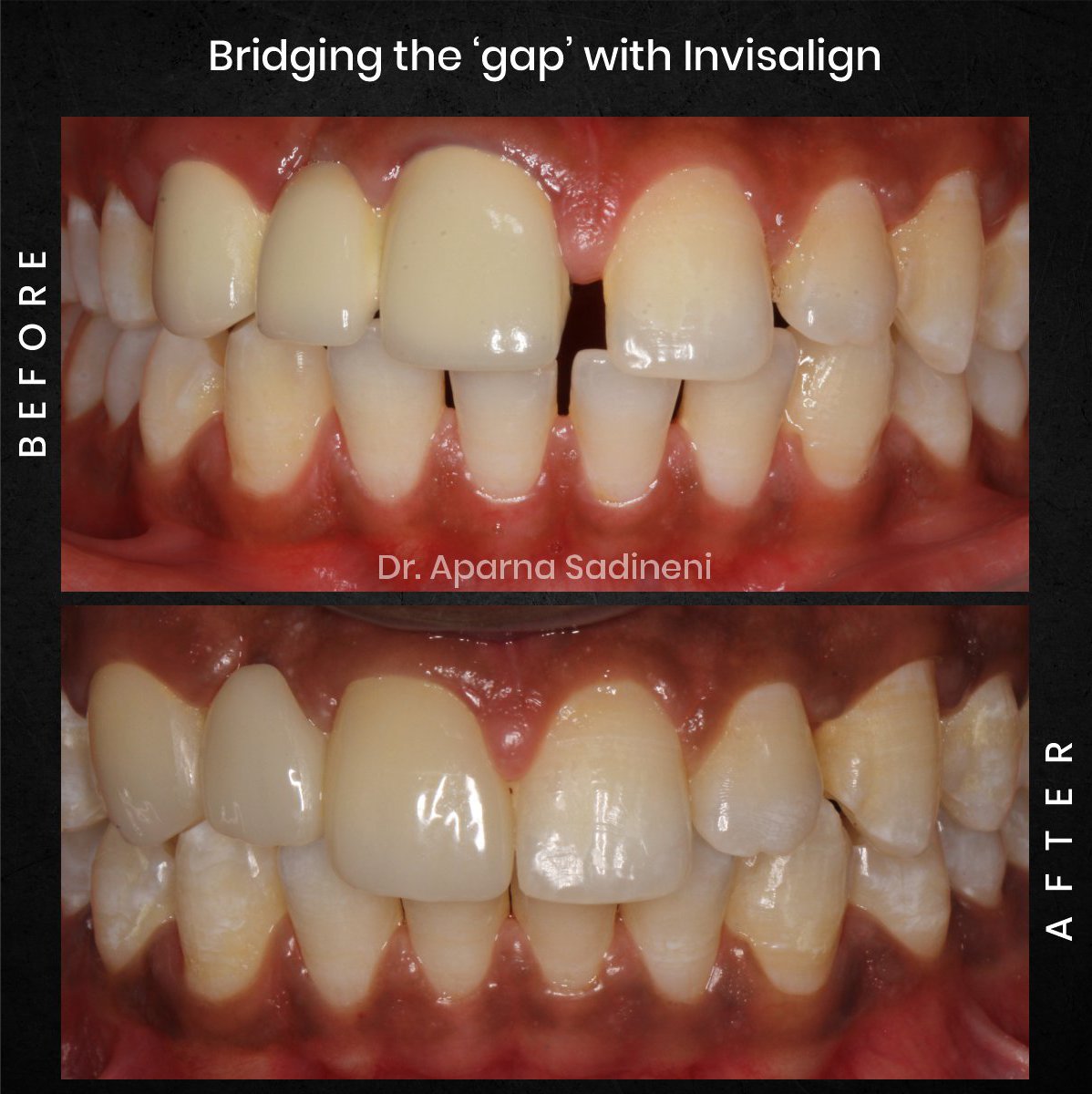 DMD-CYCLE-3-POST-1-CAROUSEL-BA-BHARATH_1