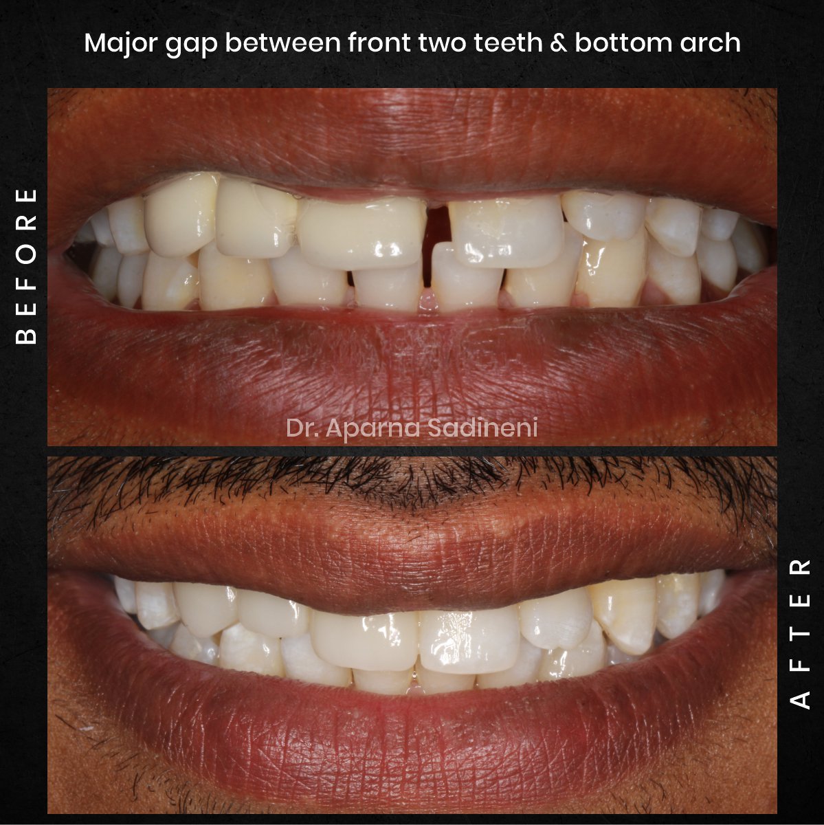 DMD-CYCLE-3-POST-1-CAROUSEL-BA-BHARATH_2