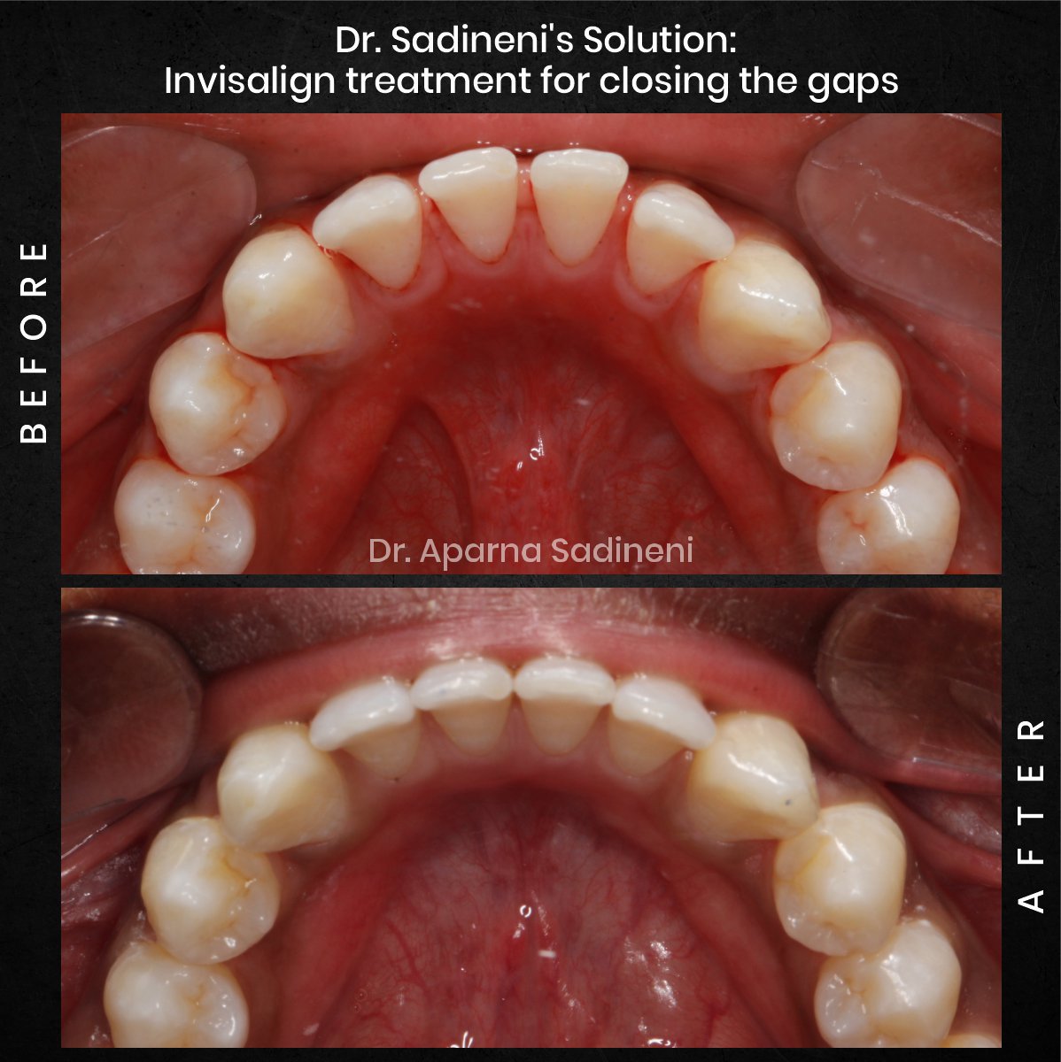 DMD-CYCLE-3-POST-1-CAROUSEL-BA-BHARATH_3