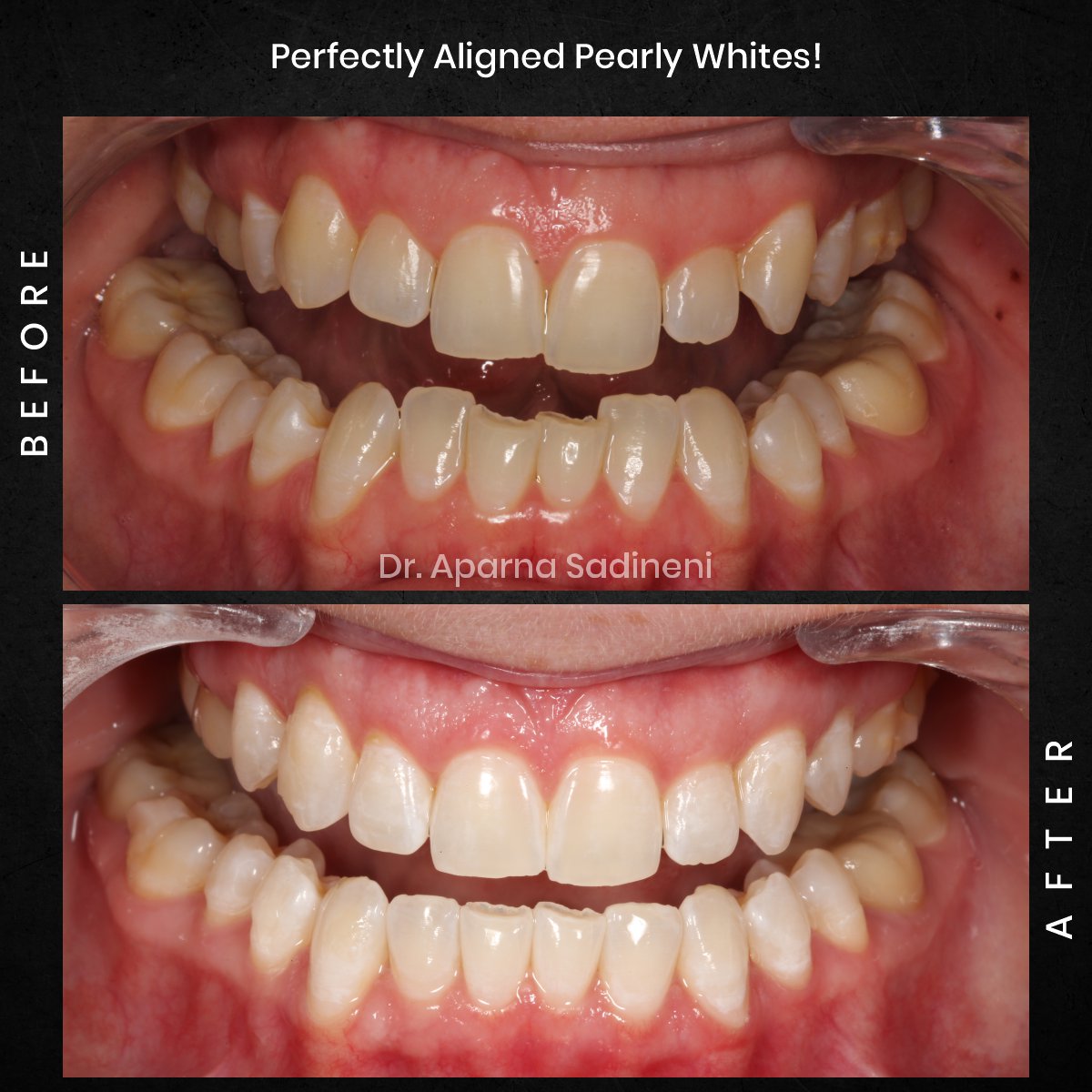 DMD-CYCLE-3-POST-3-BA-CAROUSEL-AMBER-P._1