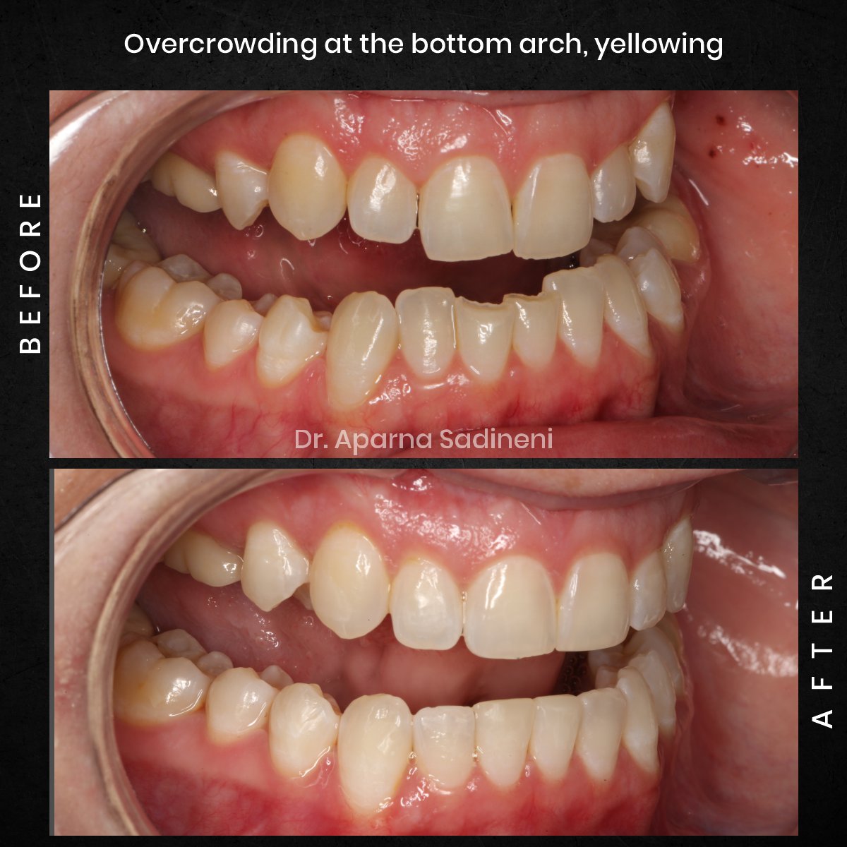 DMD-CYCLE-3-POST-3-BA-CAROUSEL-AMBER-P._2