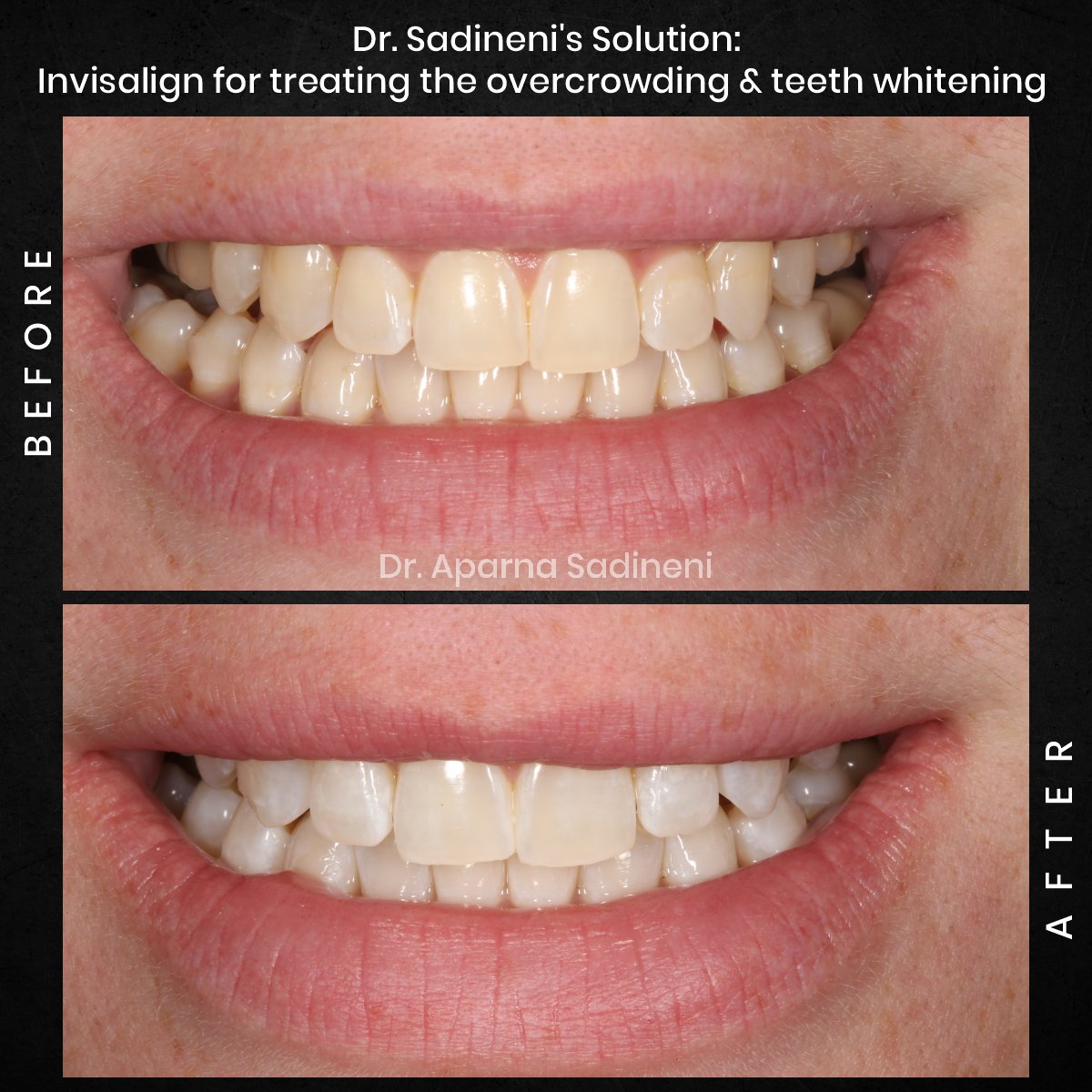 DMD-CYCLE-3-POST-3-BA-CAROUSEL-AMBER-P._3