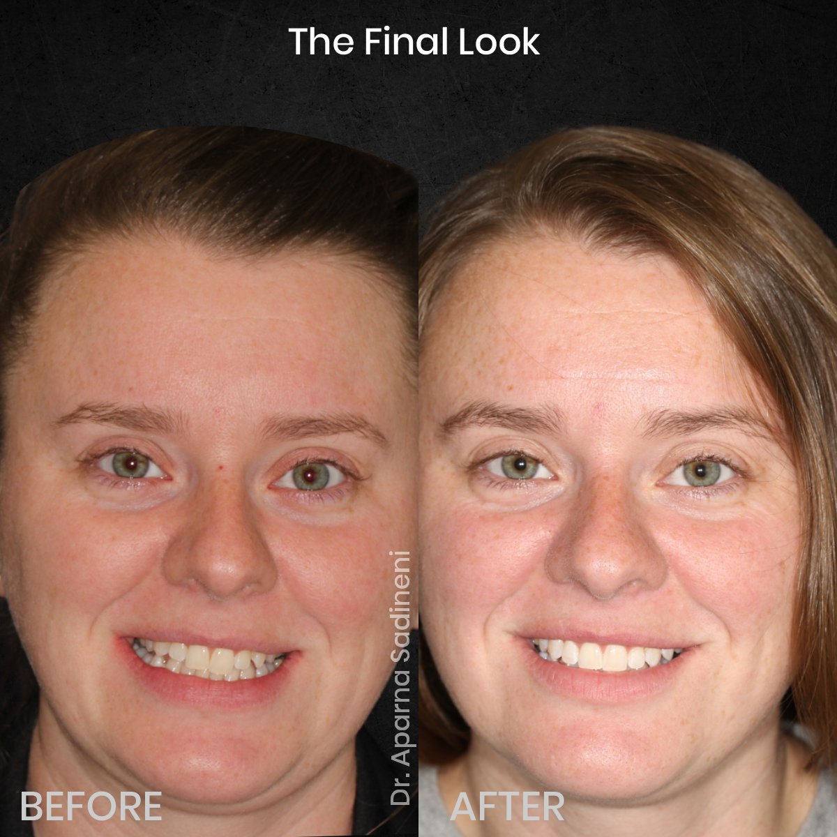 DMD-CYCLE-3-POST-3-BA-CAROUSEL-AMBER-P._4