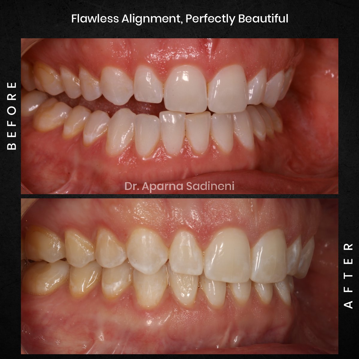 DMD-DEC-GRID-1-POST-1-TEETH-BA-ALICIA_4