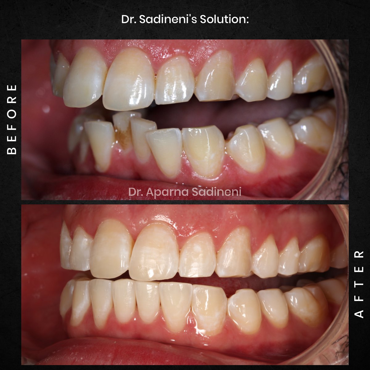 DMD-DEC-GRID-1-POST-3-HEADSHOT-BA-JOSHUA_3