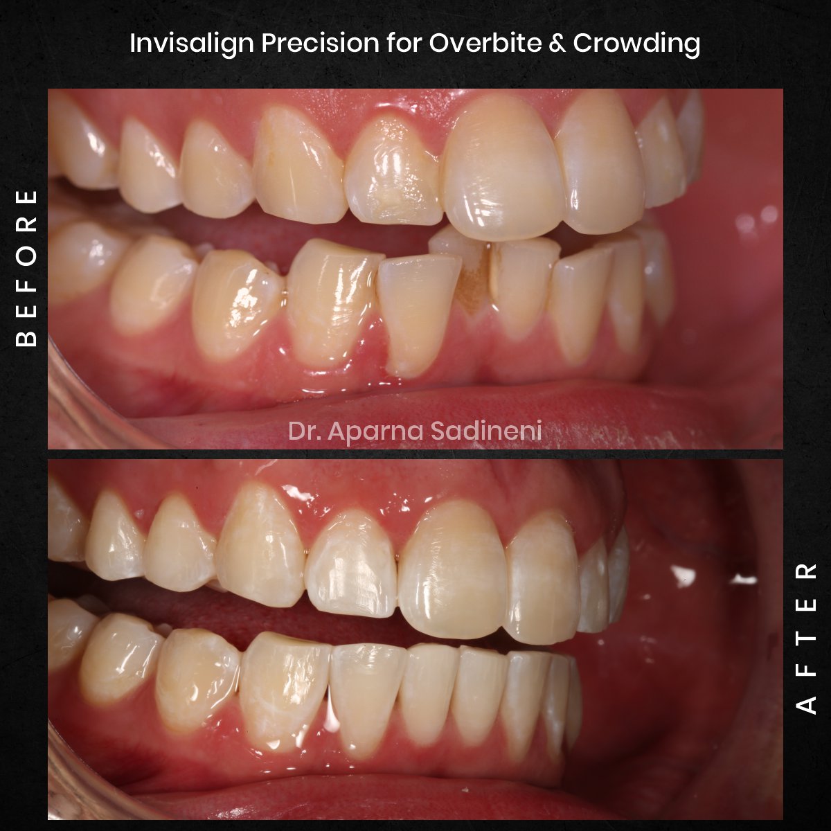 DMD-DEC-GRID-1-POST-3-HEADSHOT-BA-JOSHUA_4