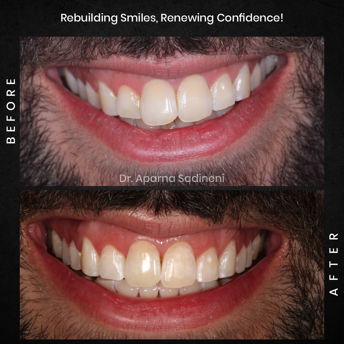 DMD-DEC-GRID-1-POST-3-HEADSHOT-BA-JOSHUA_6