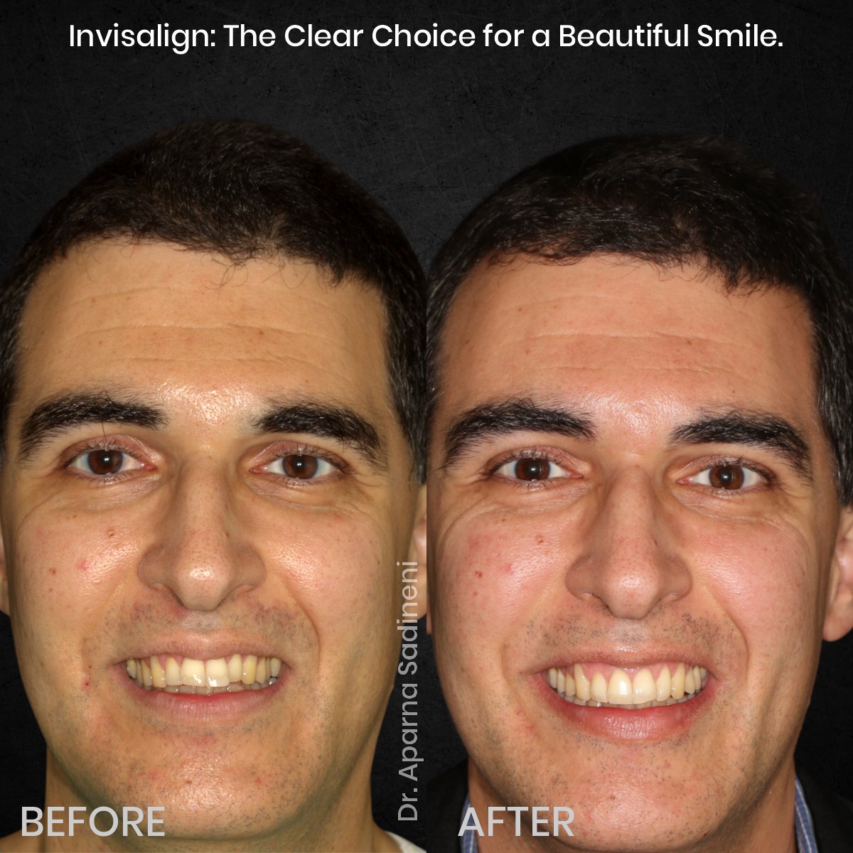 DMD-NOV-GRID-1-POST-3-HEADSHOT-BA-FRANCESCO_1