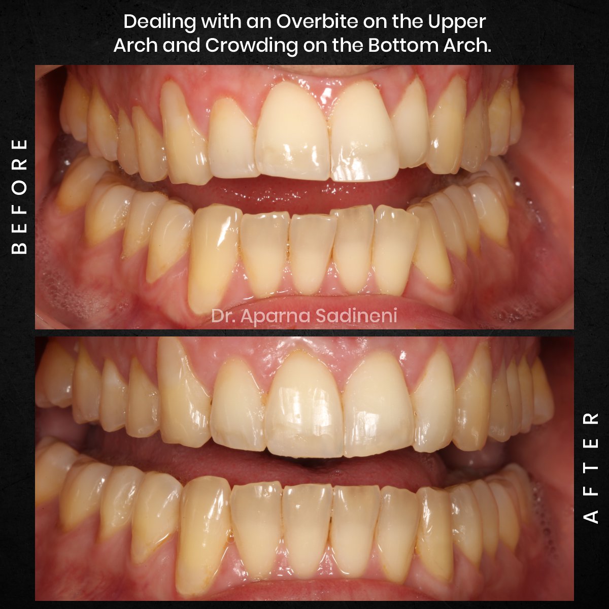 DMD-NOV-GRID-1-POST-3-HEADSHOT-BA-FRANCESCO_2