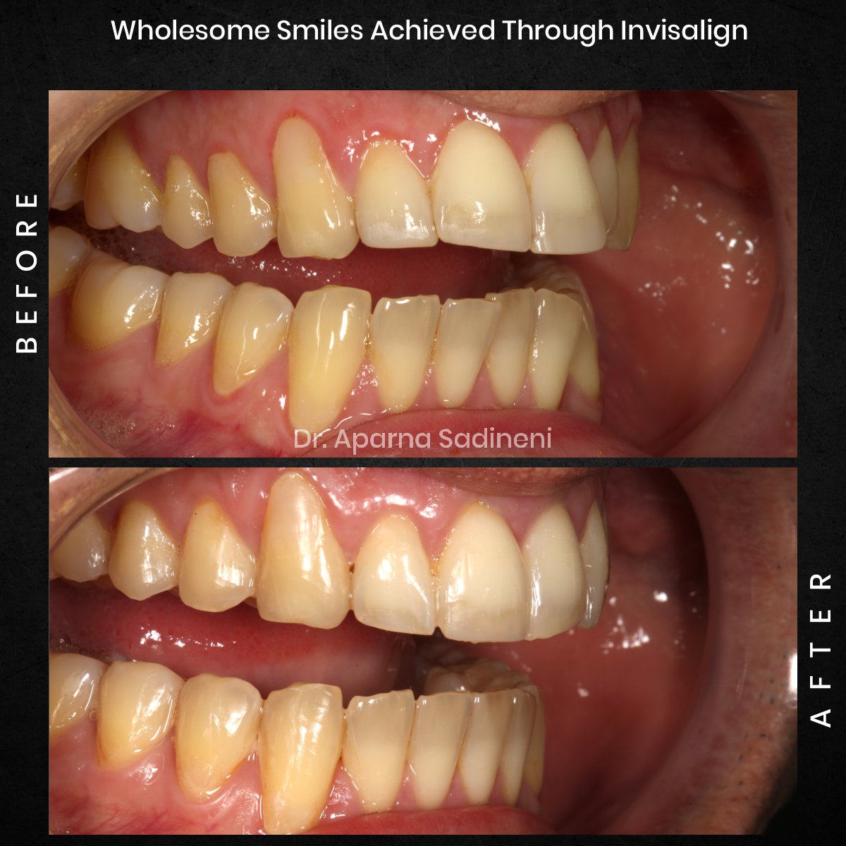 DMD-NOV-GRID-1-POST-3-HEADSHOT-BA-FRANCESCO_4