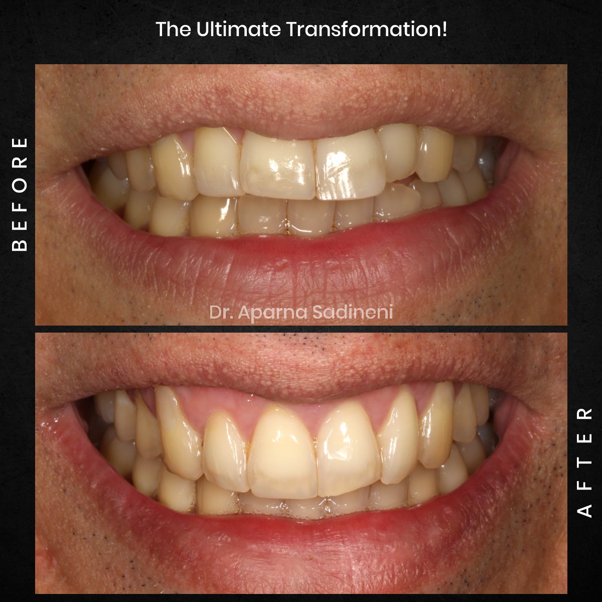 DMD-NOV-GRID-1-POST-3-HEADSHOT-BA-FRANCESCO_5