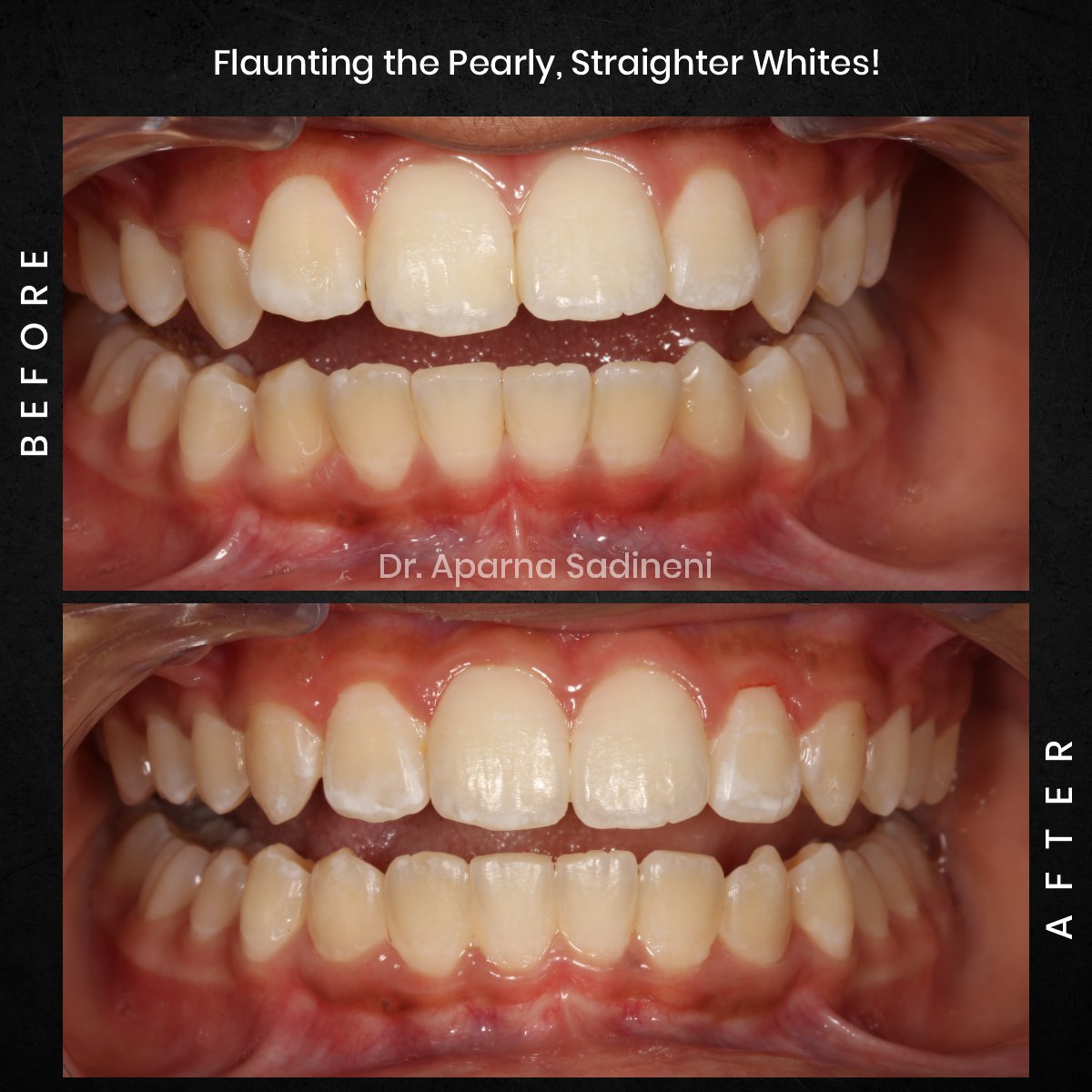 DMD-NOV-GRID-3-POST-5-HEADSHOT-B_A-ARUSH_5-1