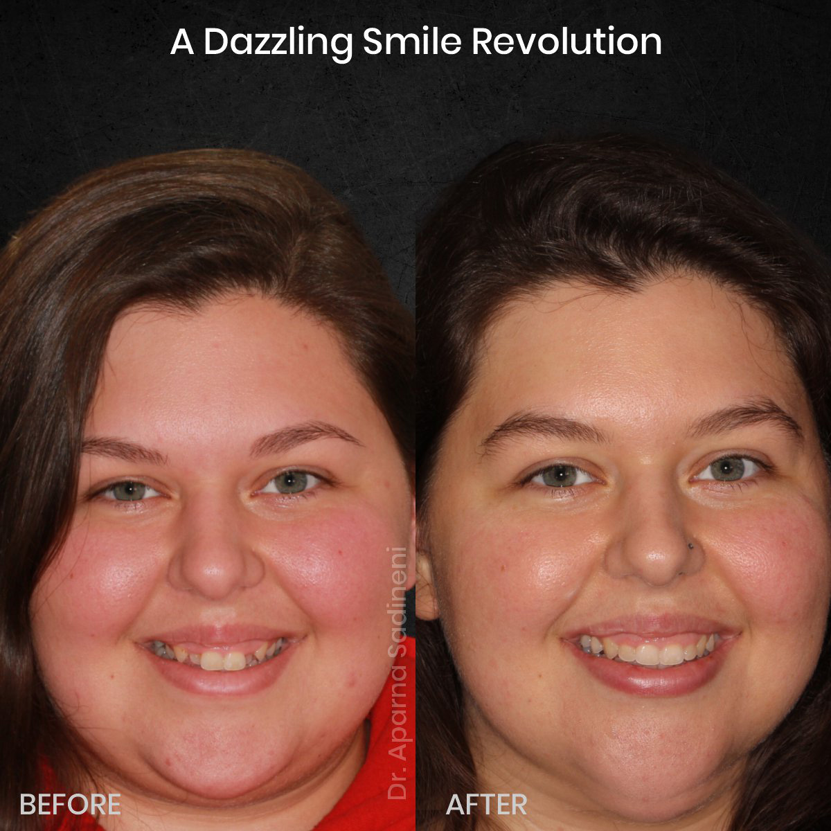 DMD OCT GRID 1 B&A Brianna M_1 (1)