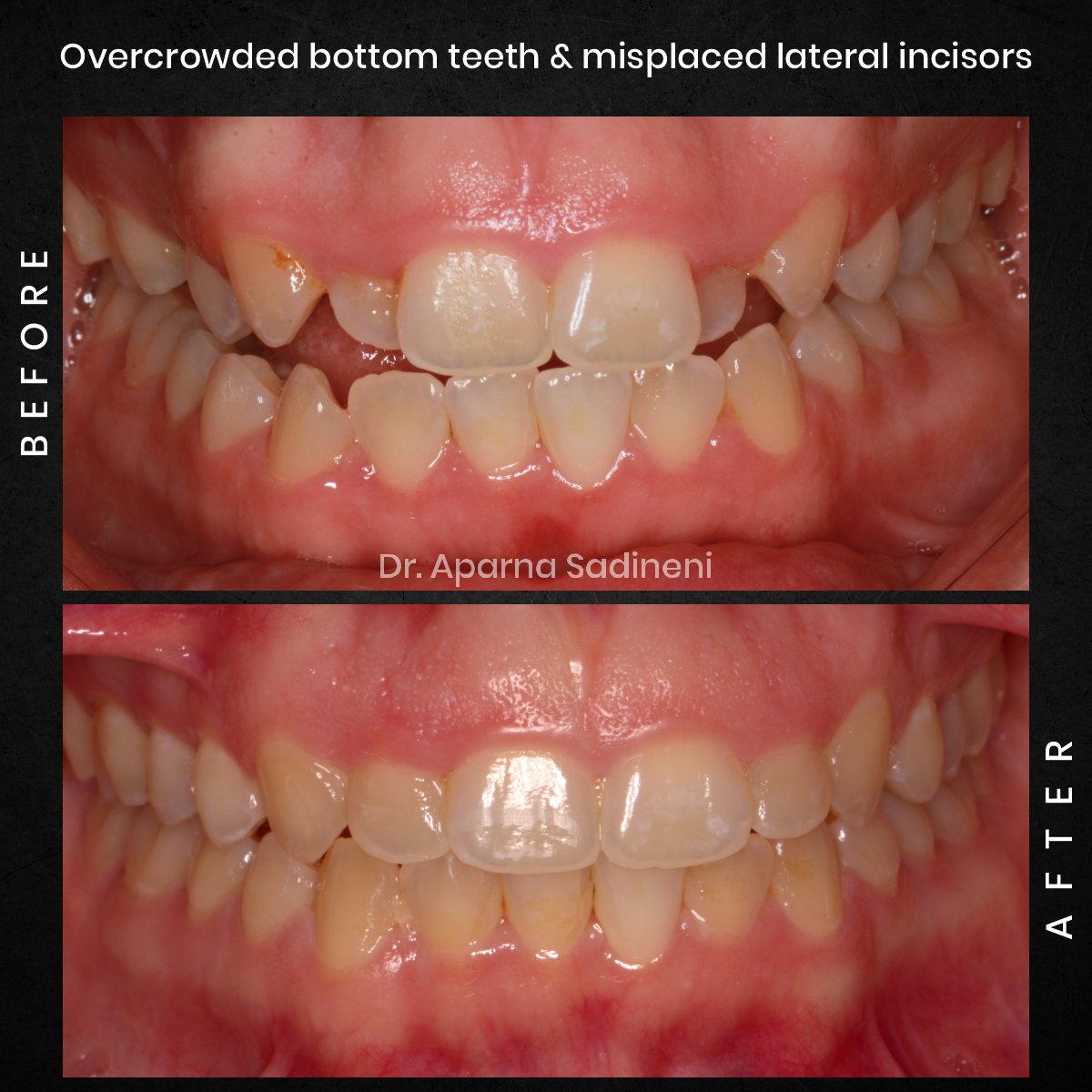 DMD-OCT-GRID-1-BA-Brianna-M_2-1