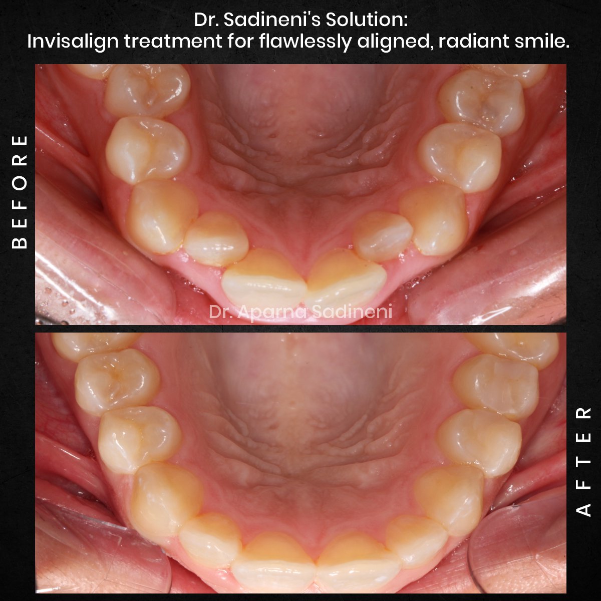 DMD-OCT-GRID-1-BA-Brianna-M_3-1