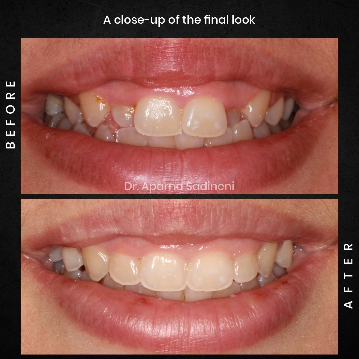 DMD OCT GRID 1 B&A Brianna M_4 (1)