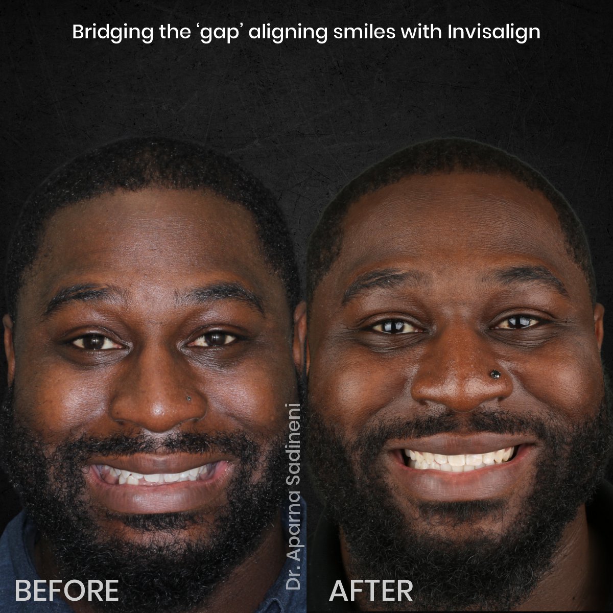 DMD-OCT-GRID-1-B_A-DEARIUS_1