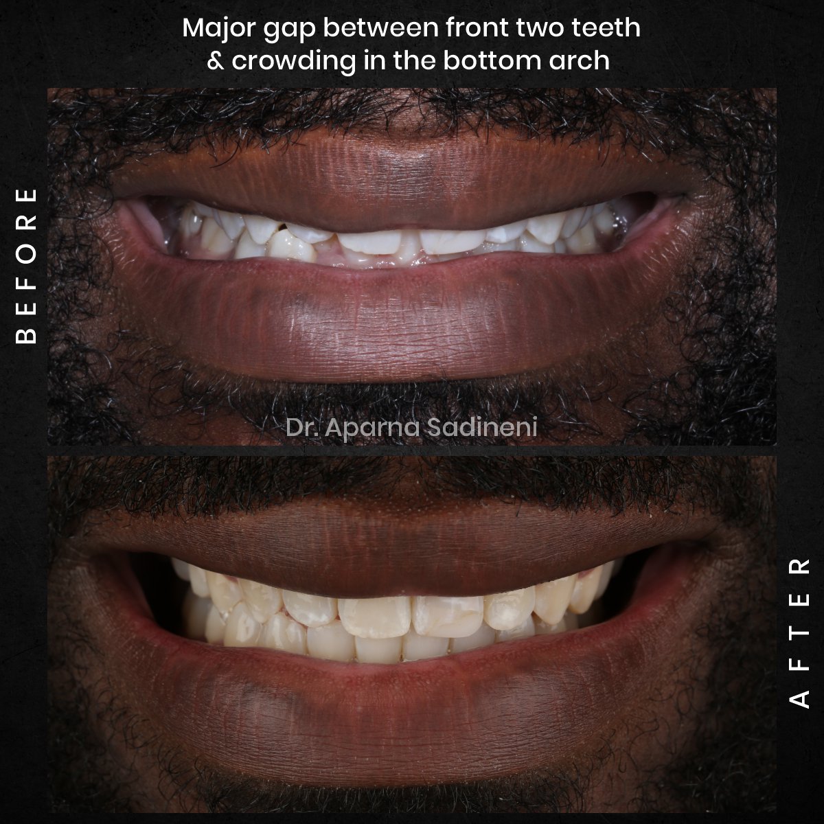 DMD-OCT-GRID-1-B_A-DEARIUS_2