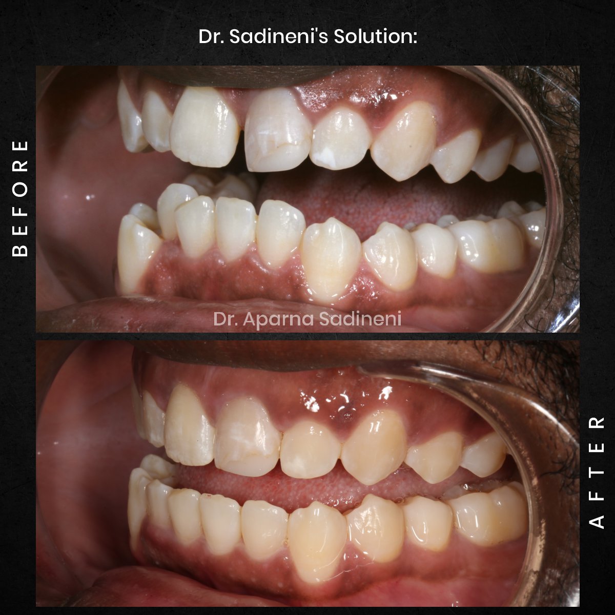 DMD-OCT-GRID-1-B_A-DEARIUS_3