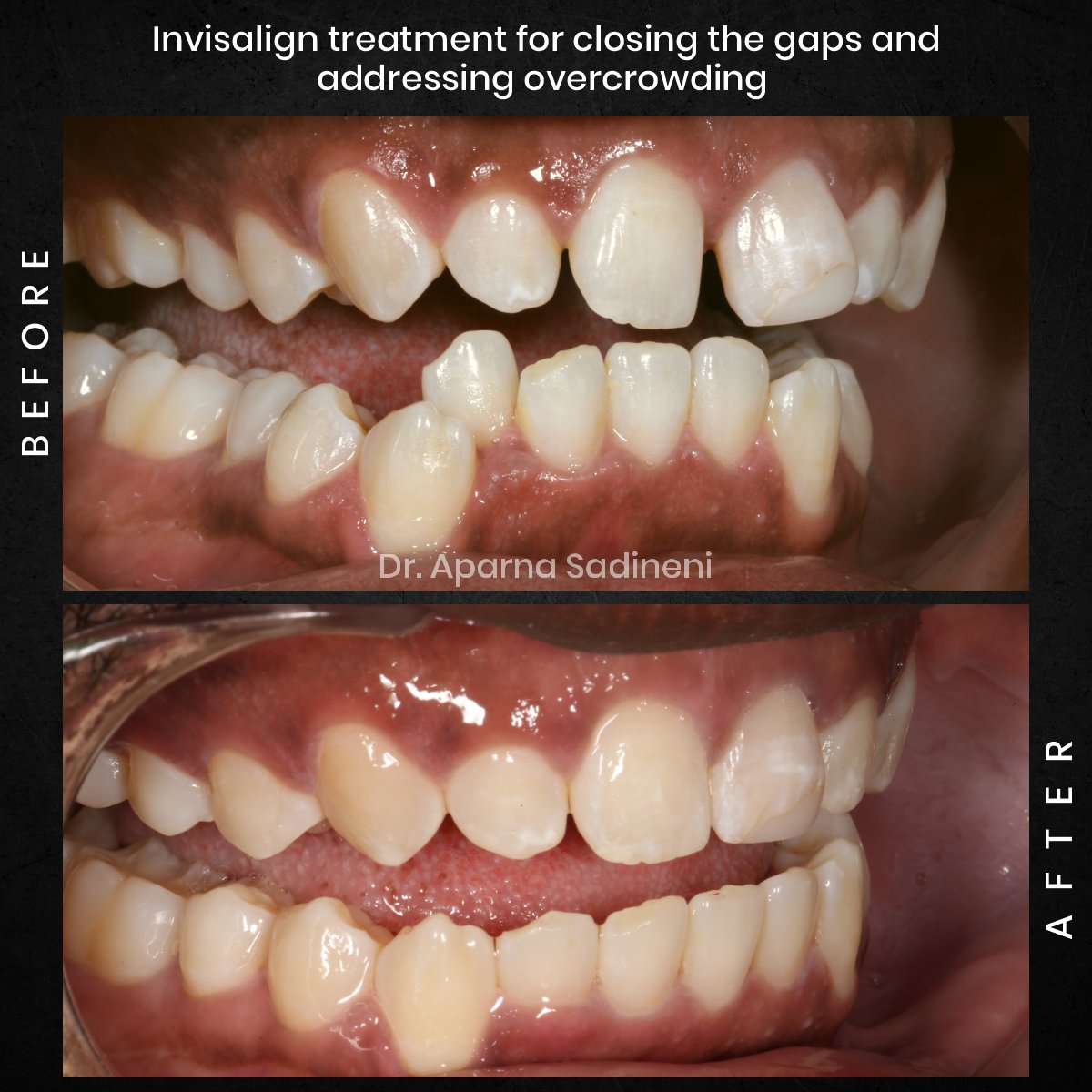 DMD-OCT-GRID-1-B_A-DEARIUS_4