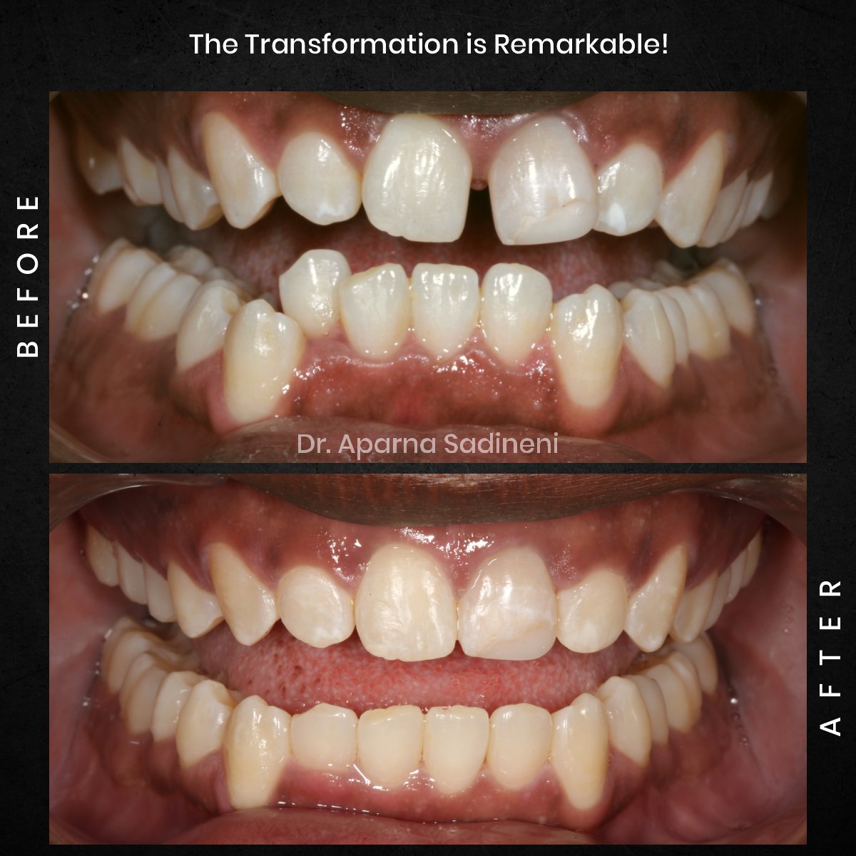 DMD-OCT-GRID-1-B_A-DEARIUS_5