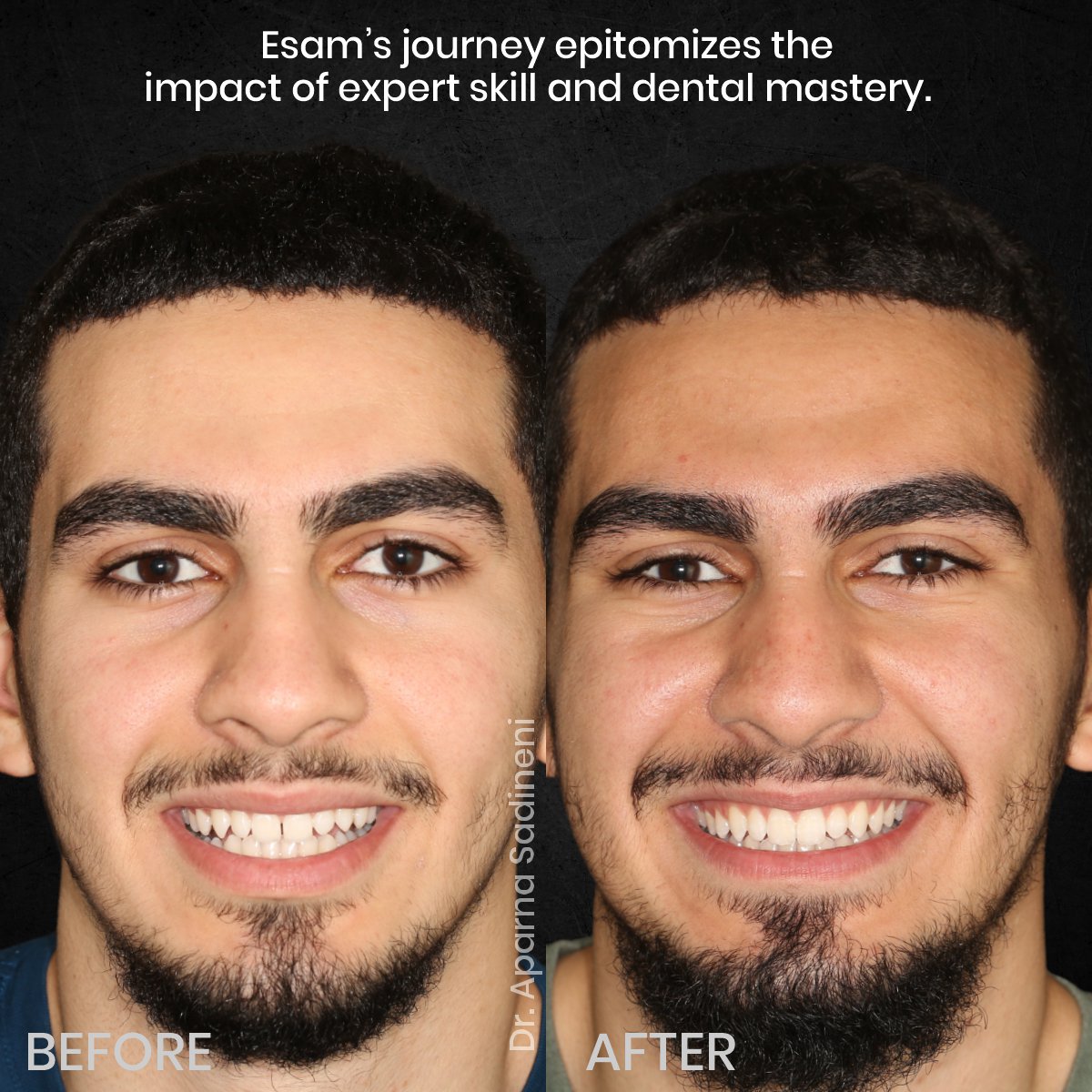 DMD-OCT-GRID-4-BA-TEETH-CAROUSEL-Esam-Dobal-5