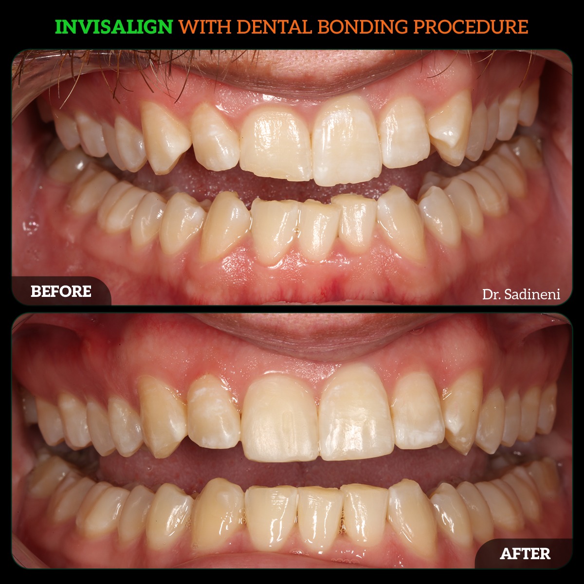 WhatsApp-Image-2024-05-23-at-7.04.21-PM-1